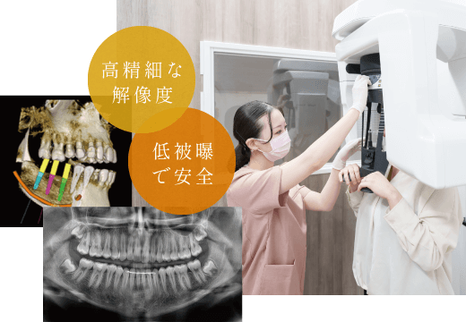 高精細な解像度・低被曝で安全